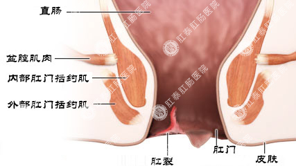 无锡肛肠