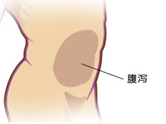 如何治疗腹泻才能不走误区